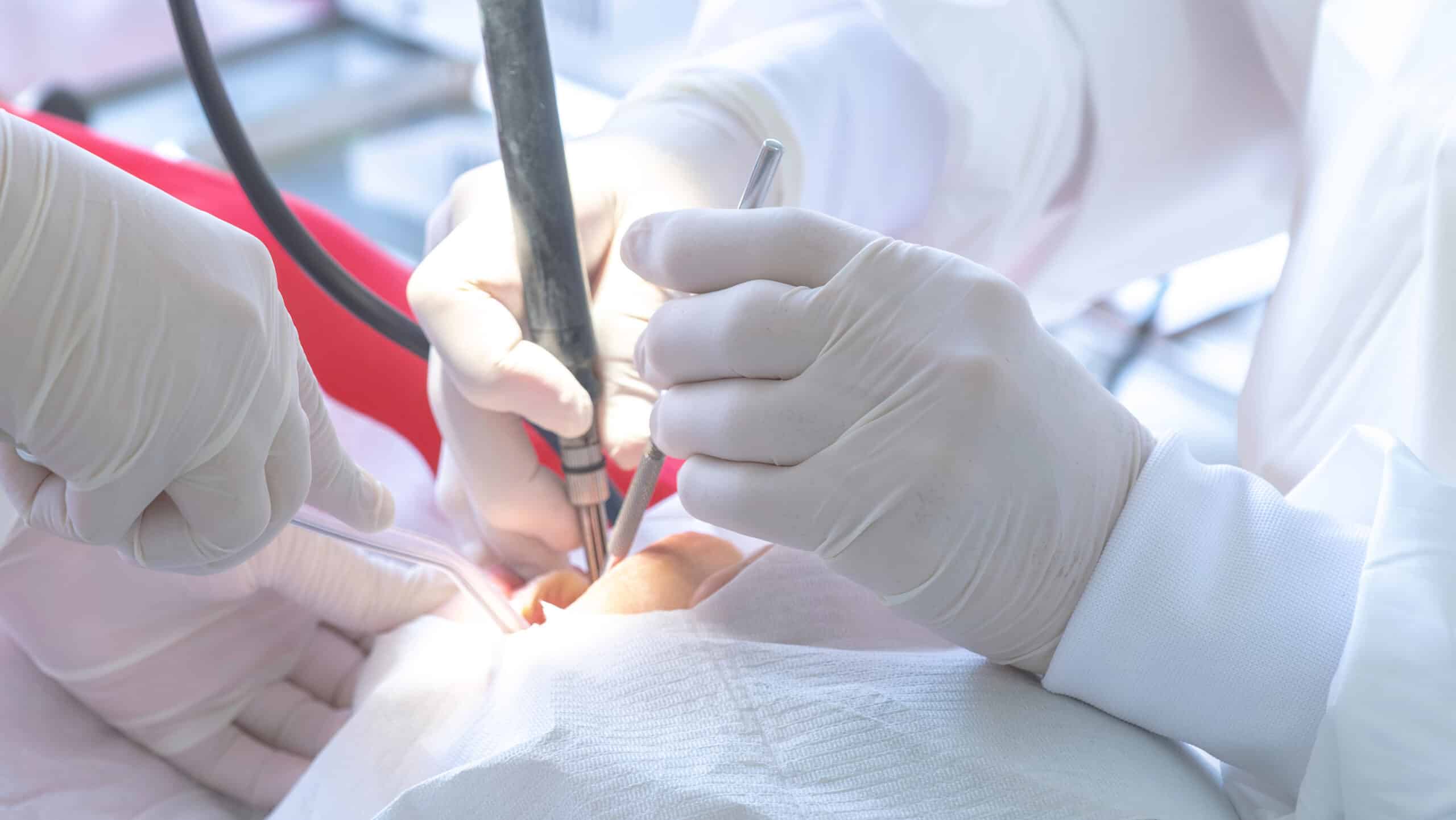 Oralchirurgie: Hände mit chirurgischen Instrumenten